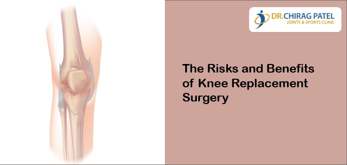 Risks and Benefits of Knee Replacement Surgery