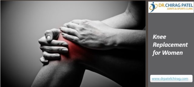 Knee Replacement for Women Dr Chirag Patel