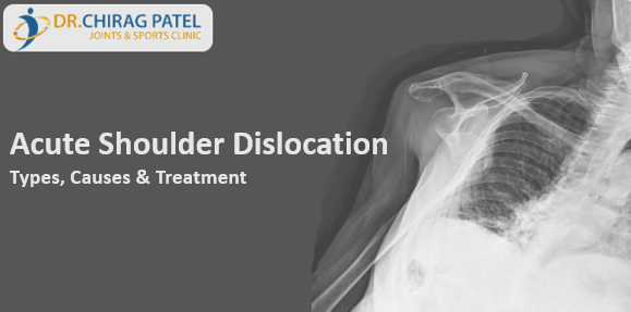 Acute Shoulder Dislocation Treatment in Surat