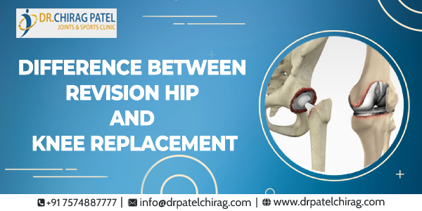 primary and revision total hip and knee replacement