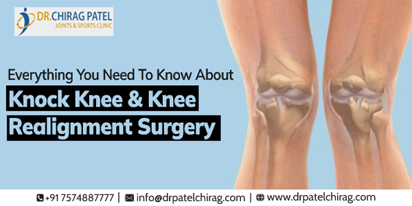 can knock knees be corrected with surgery