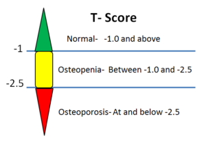 Bone Density T score Parameters 