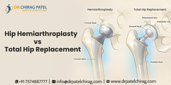 hemiarthroplasty vs total hip replacement