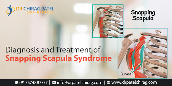 Exercises For Snapping Scapula Syndrome MJYUN