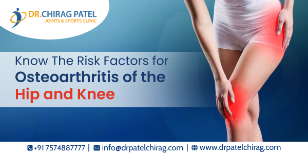 Know The Risk Factors for Osteoarthritis of the Hip and Knee