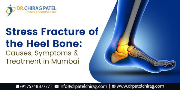 Stress Fracture of the Heel Bone | Calcaneal stress fracture