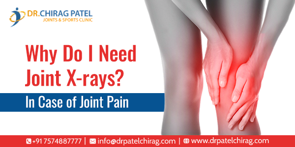 Joint X-ray in Diagnosing Joint Pain