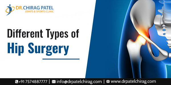 Different Types of Hip Surgery