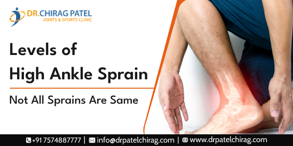 Levels of High Ankle Sprain | specialist and foot and ankle surgeon in Mumbai
