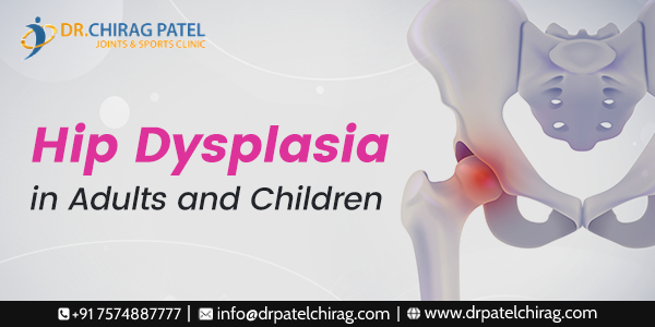 Hip Dysplasia in Adults and Children