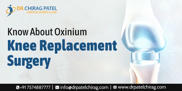 Know About Oxinium Knee Replacement Surgery