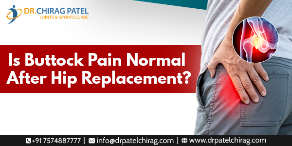 how long does buttock pain last after hip replacement | Dr Chirag Patel