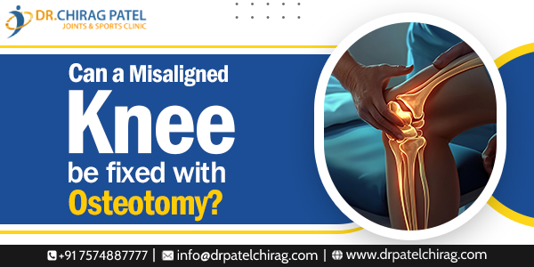 Knee Osteotomy for Malalignment | Dr Chirag Patel | Knee Osteotomy Surgeon in Mumbai
