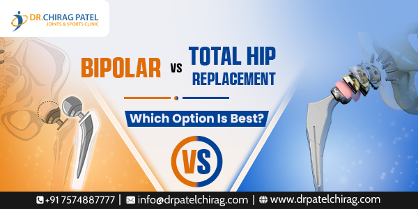Bipolar Hip Replacement in Mumbai | Dr Chirag Patel