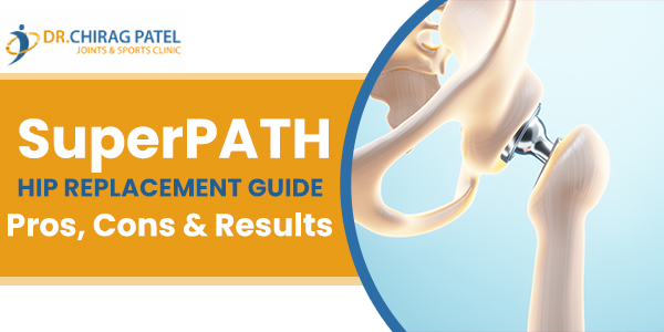 Superpath Hip Replacement Pros and Cons