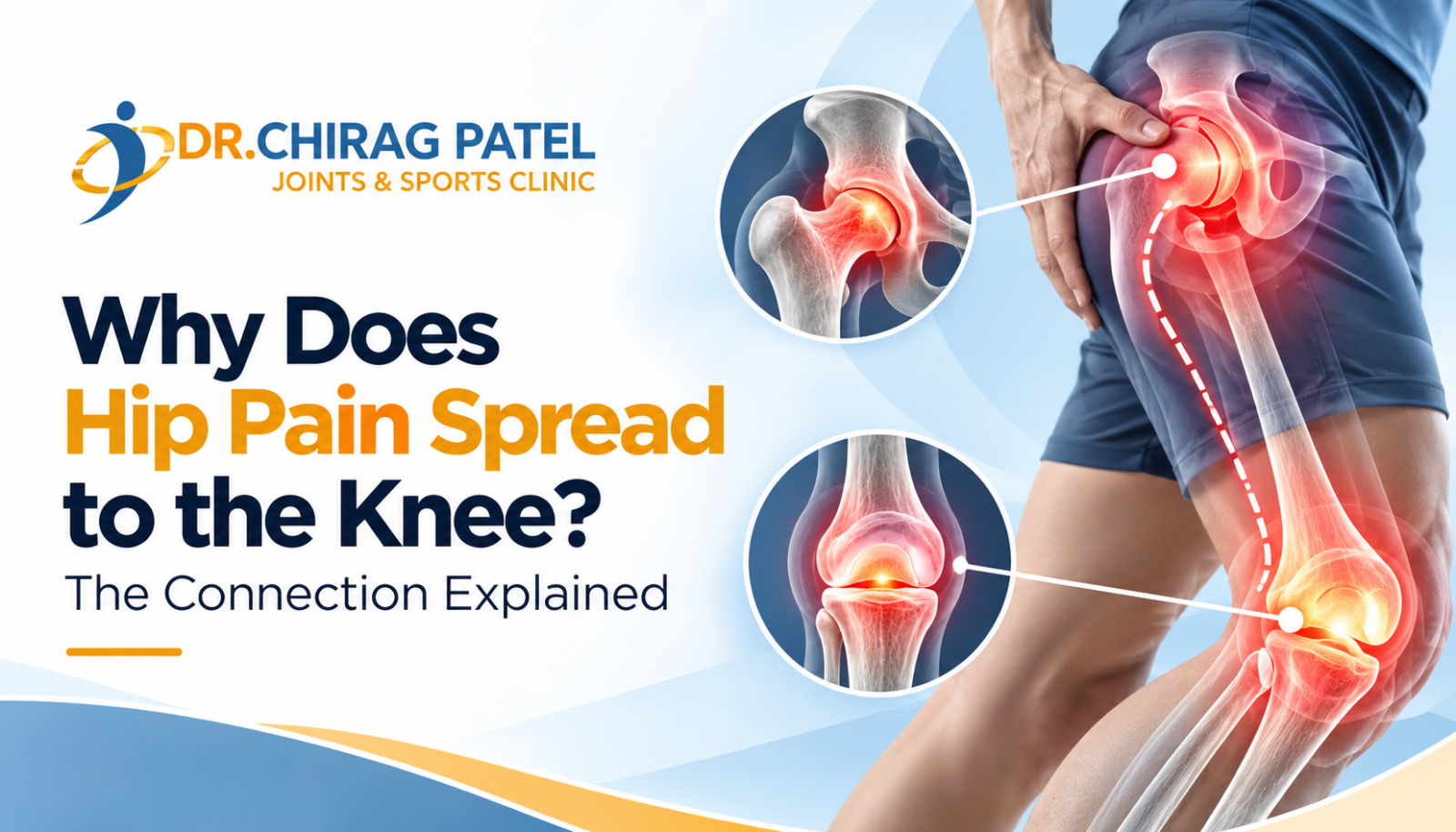Hip pain spreading to the knee
